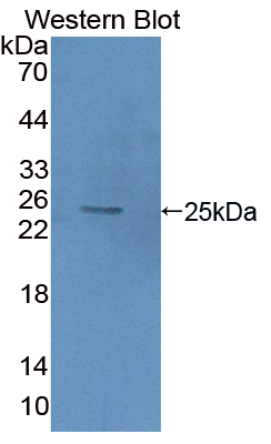 PAC052Hu01.jpg