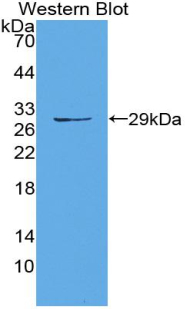 Polyclonal Antibody to Matrix Metalloproteinase 14 (MMP14)