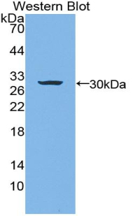 Polyclonal Antibody to Laminin Beta 3 (LAMb3)