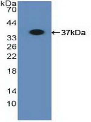 PAC092Hu01.jpg