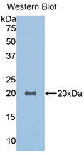 Polyclonal Antibody to Growth Differentiation Factor 1 (GDF1)