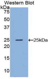 Polyclonal Antibody to Noggin (NOG)