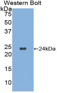 Polyclonal Antibody to Noggin (NOG)