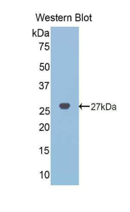 Polyclonal Antibody to Noggin (NOG)