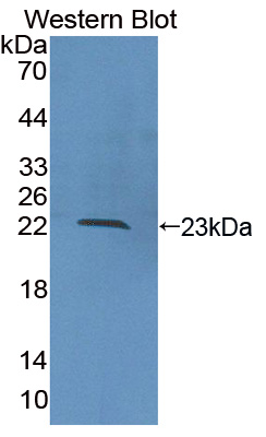 PAC136Hu01.jpg