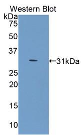 Polyclonal Antibody to Collagen Type IV Alpha 5 (COL4a5)