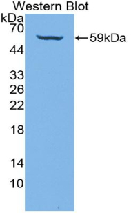 PAC143Hu01.jpg