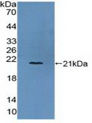 PAC148Hu01.jpg