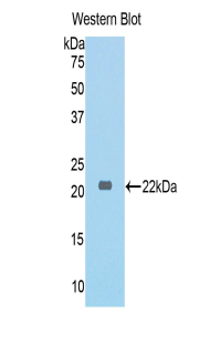 Polyclonal Antibody to Collagen Type VI Alpha 1 (COL6a1)