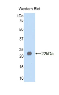 PAC175Hu02.jpg