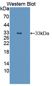 PAC187Hu01.jpg