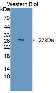 Polyclonal Antibody to Desmoplakin (DSP)