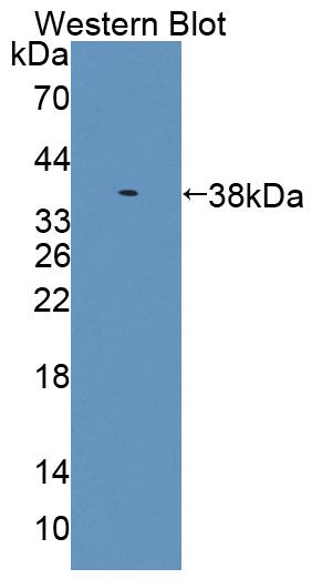 PAC212Hu01.jpg