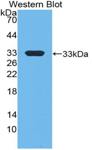 Polyclonal Antibody to E1A Binding Protein P300 (EP300)