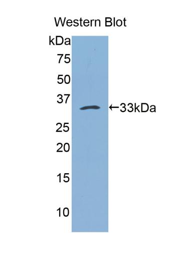 Polyclonal Antibody to Bleomycin Hydrolase (BLMH)