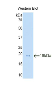 Polyclonal Antibody to Profilin 1 (PFN1)