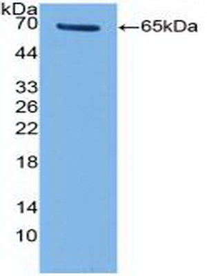 Polyclonal Antibody to Telomerase Reverse Transcriptase (TERT)