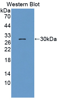 PAC257Hu01.jpg