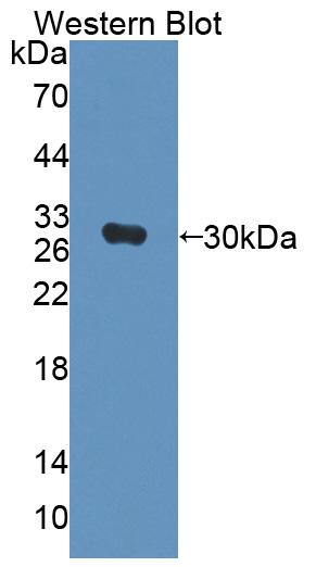 Polyclonal Antibody to Centromere Protein J (CENPJ)