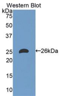 Polyclonal Antibody to Apolipoprotein M (APOM)