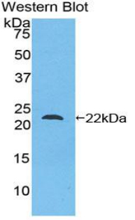 Polyclonal Antibody to Mesencephalic Astrocyte Derived Neurotrophic Factor (MANF)