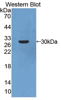 PAC301Hu01.jpg