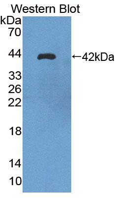 PAC311Hu01.jpg