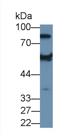 PAC313Hu02.jpg