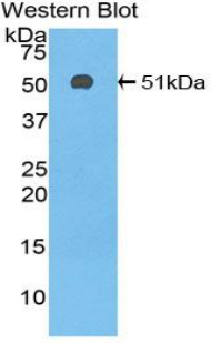 Polyclonal Antibody to Antithrombin (AT)