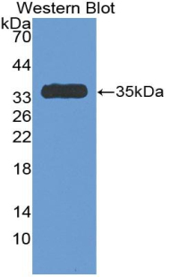 Polyclonal Antibody to Antithrombin (AT)