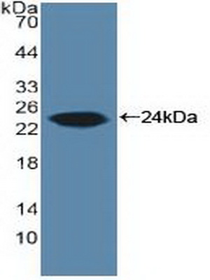 PAC319Hu01.jpg