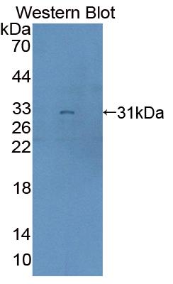 Polyclonal Antibody to Bcl6 Corepressor (BCOR)