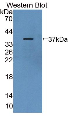 Polyclonal Antibody to Calcium Activated Nucleotidase 1 (CANT1)