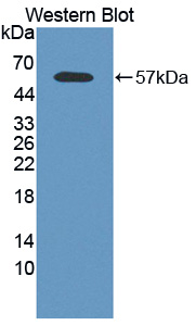 PAC358Hu01.jpg