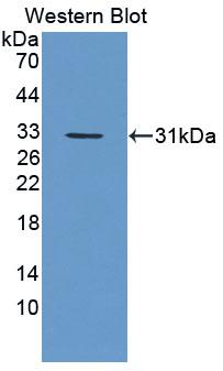 Polyclonal Antibody to Carboxylesterase 1 (CES1)