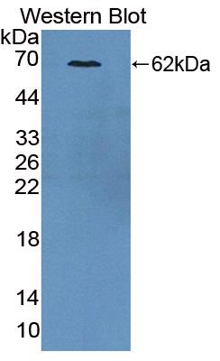 Polyclonal Antibody to Cytoskeleton Associated Protein 2 (CKAP2)