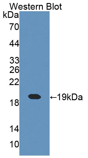 Polyclonal Antibody to Cellular Retinoic Acid Binding Protein 1 (CRABP1)