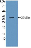 Polyclonal Antibody to Cysteine Rich Secretory Protein 1 (CRISP1)