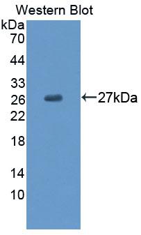 Polyclonal Antibody to Carnitine-O-Octanoyltransferase (CORT)