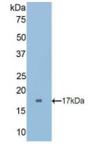 Polyclonal Antibody to Cubilin (CUBN)