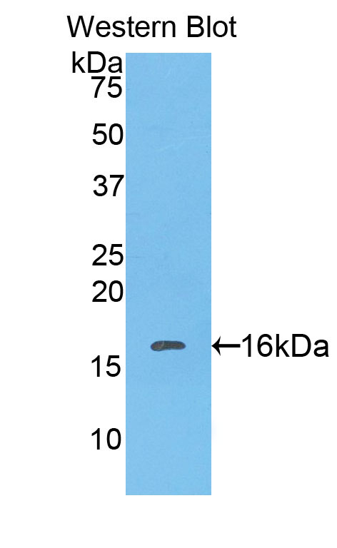 Polyclonal Antibody to Catalase (CAT)