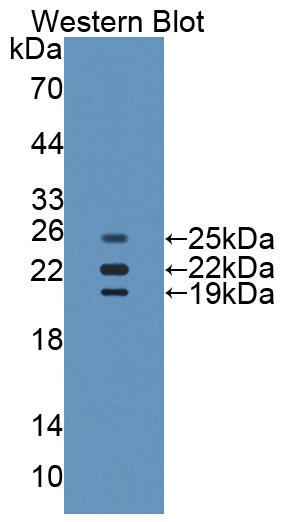 Biotin-Linked Polyclonal Antibody to Catalase (CAT)