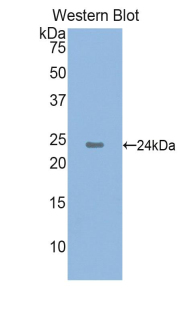 PAC419Hu71.jpg