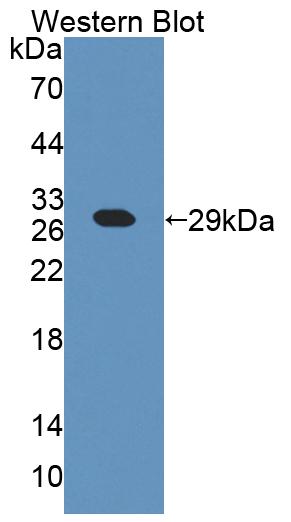 Polyclonal Antibody to Chimerin 2 (CHN2)