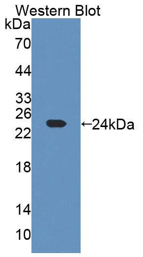 Polyclonal Antibody to Chimerin 2 (CHN2)