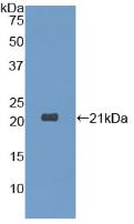 Polyclonal Antibody to Dermatopontin (DPT)