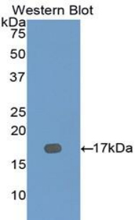 Polyclonal Antibody to Dymeclin (DYM)