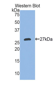 Polyclonal Antibody to Ectodysplasin A (EDA)