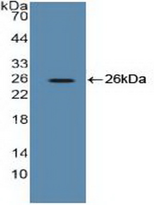 PAC453Hu01.jpg