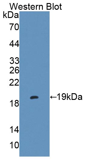 PAC461Ra01.jpg